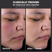 Paula's Choice SKIN PERFECTING 2% BHA Liquid Salicylic Acid Exfoliant-Facial Exfoliant for Blackheads, Enlarged Pores, Wrinkles & Fine Lines