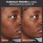 Paula's Choice SKIN PERFECTING 2% BHA Liquid Salicylic Acid Exfoliant-Facial Exfoliant for Blackheads, Enlarged Pores, Wrinkles & Fine Lines